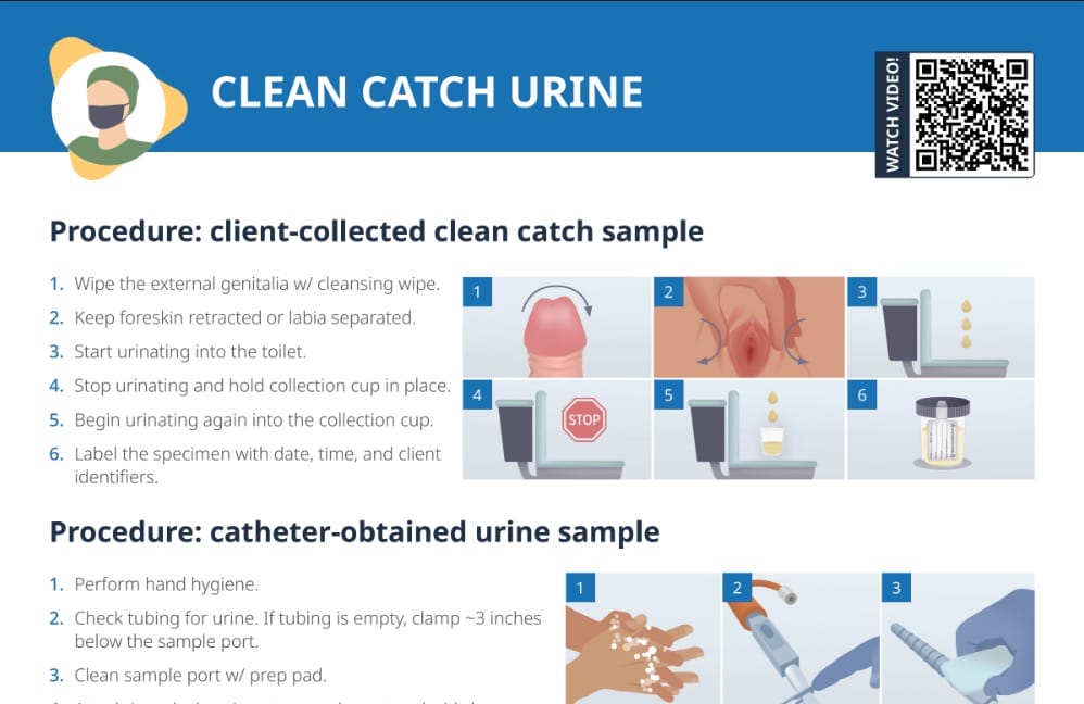 Clean catch urine sample