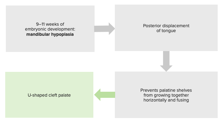 Pathophysiology of the pierre robin sequence