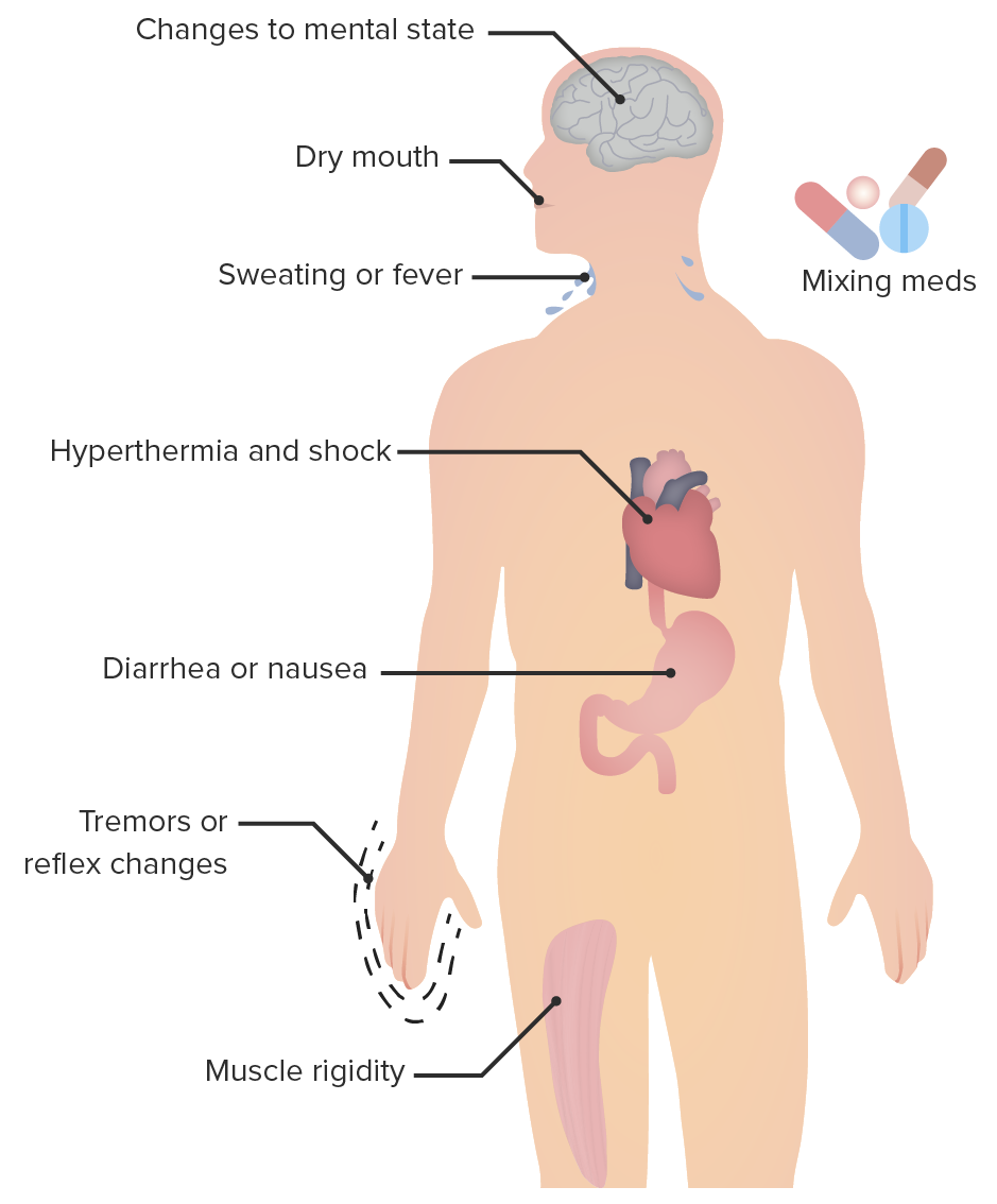 serotonin syndrome pupils