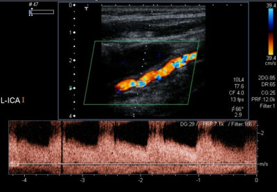 Ultrasound (Sonography) | Concise Medical Knowledge