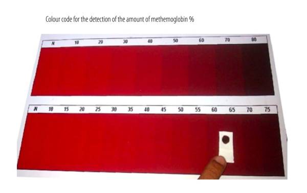Código de color sugerente de metahemoglobina metahemoglobinemia