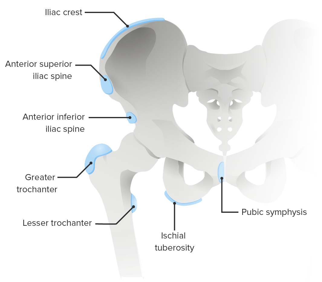 Common sites of apophyseal disorders of the pelvis