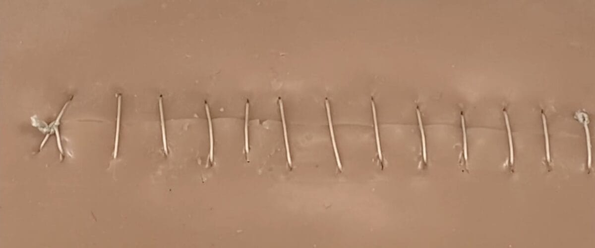 Continuous running suture