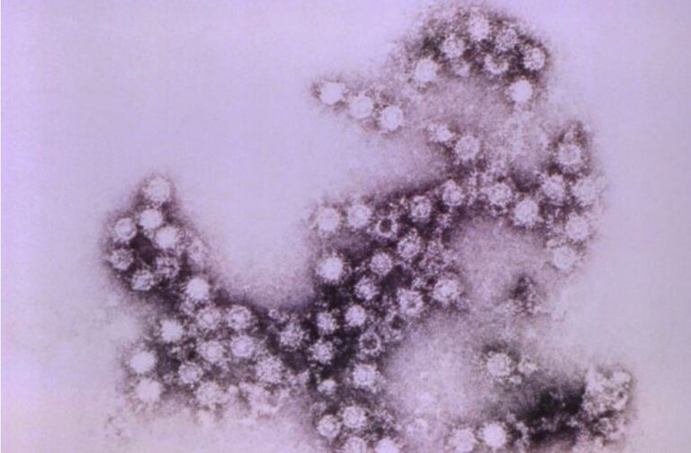 Coxsackievirus Concise Medical Knowledge