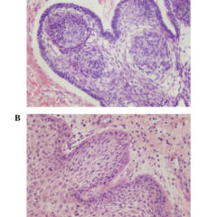 Craniopharyngioma section images captured using light microscopy