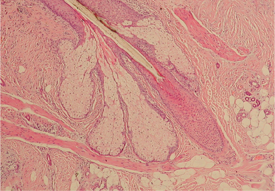 Cross section of a hair follicle