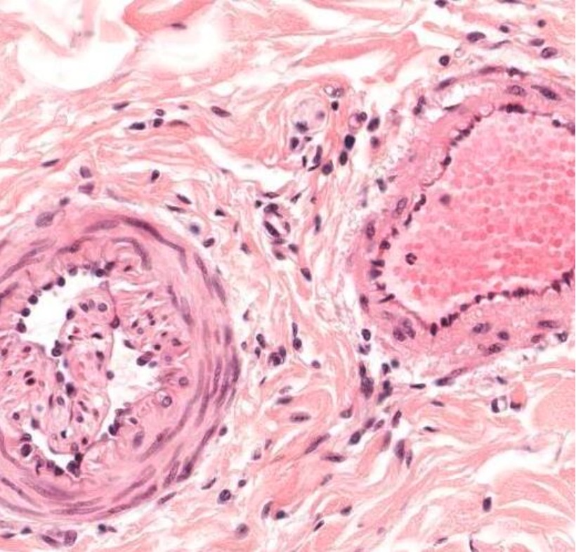 Cross-section of a small artery (left) and a small vein (right)