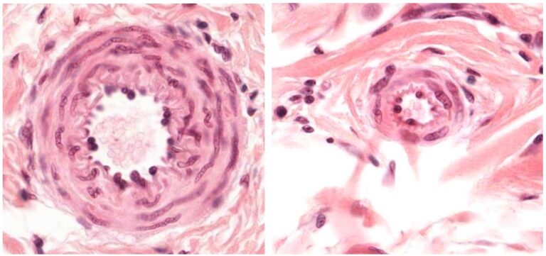 Arterias Histología Concise Medical Knowledge