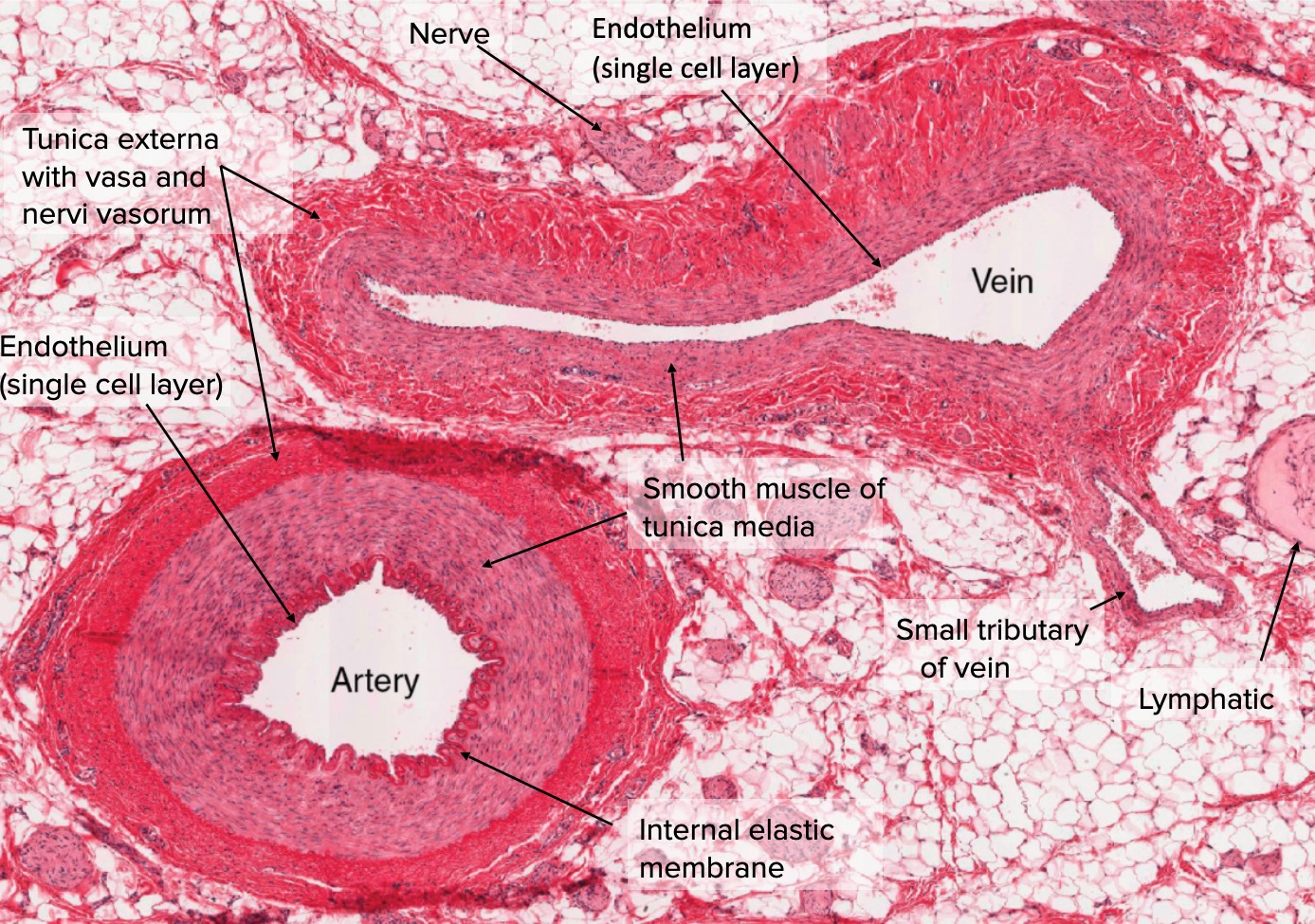 muscular artery vs elastic artery histology