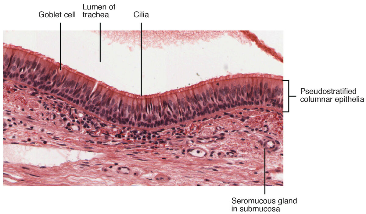 Sección transversal del epitelio columnar pseudoestratificado
