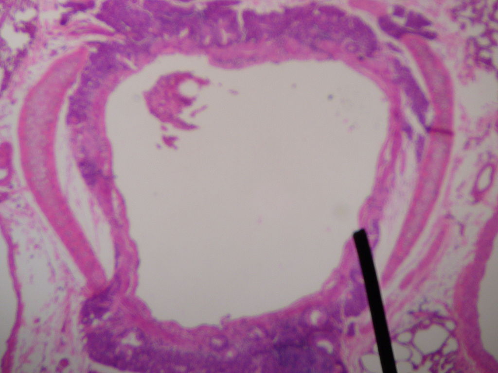 secondary bronchus histology