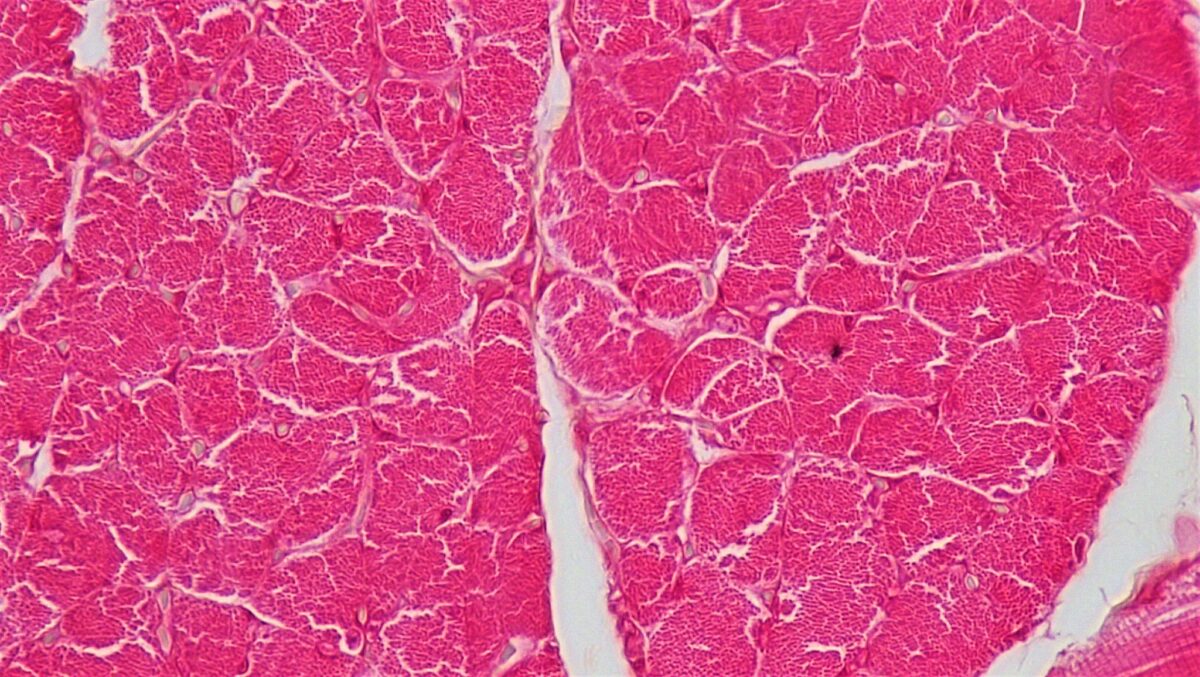 Cross section of skeletal muscle