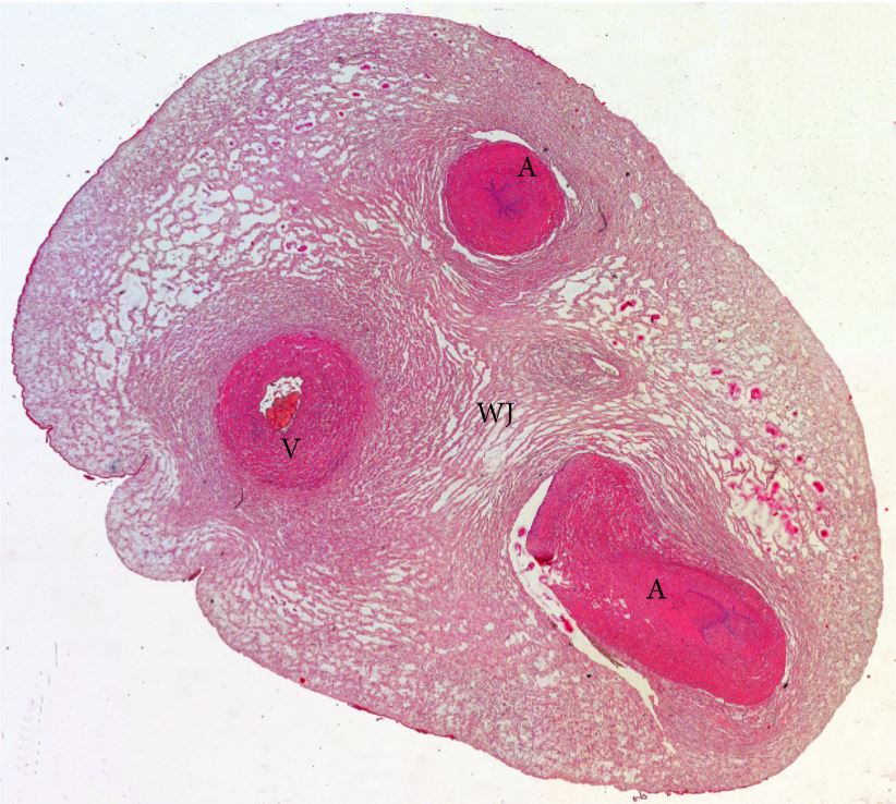 Cross section of the human umbilical cord