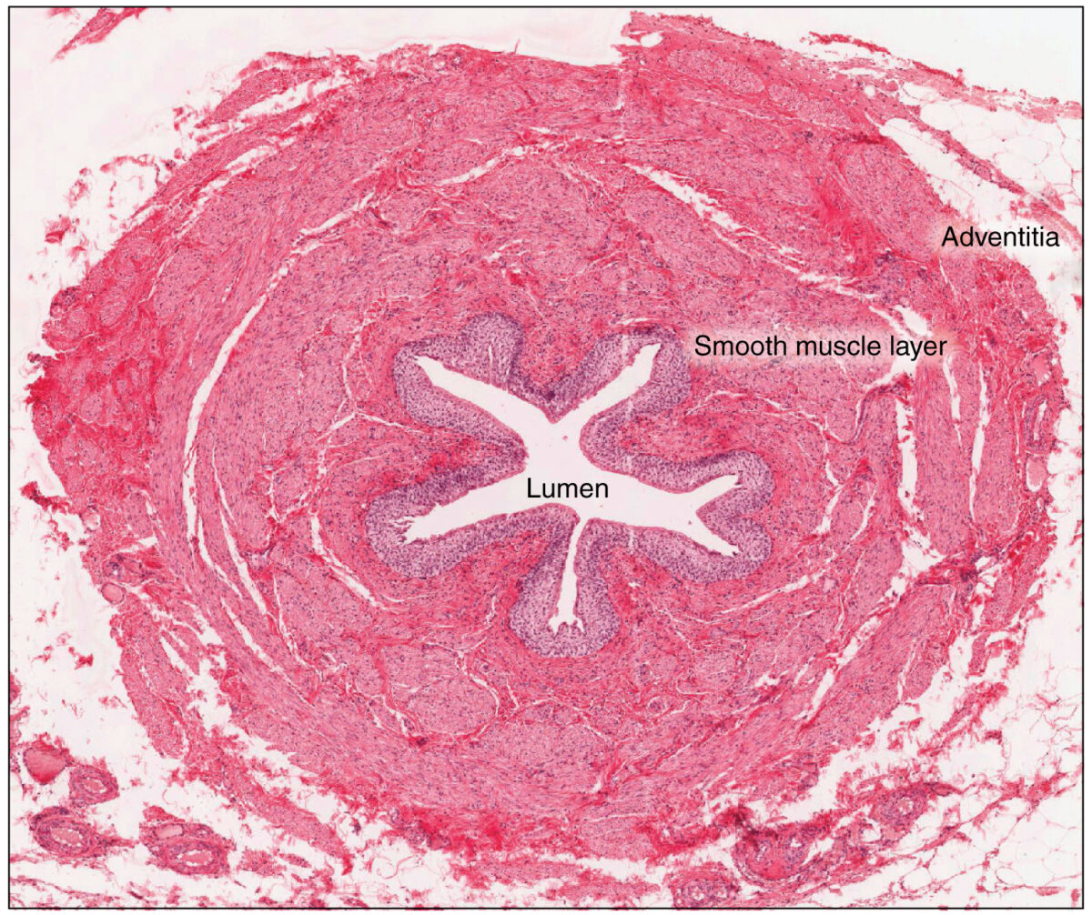 Visão histológica transversal do ureter