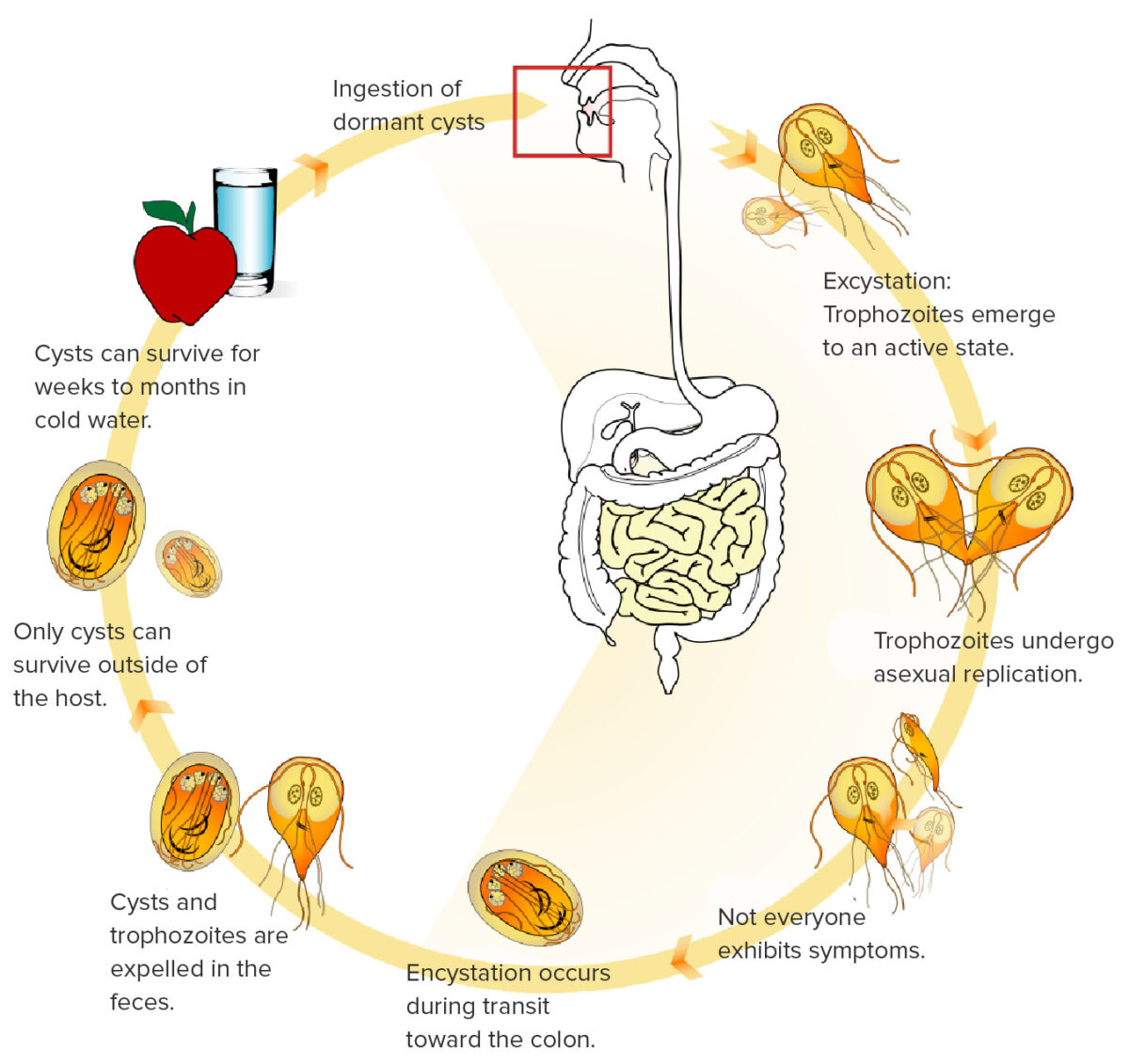 giardia diarrhea uptodate)