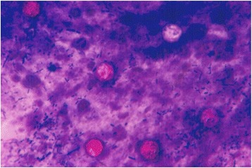 Cyclospora cayetanensis oocysts