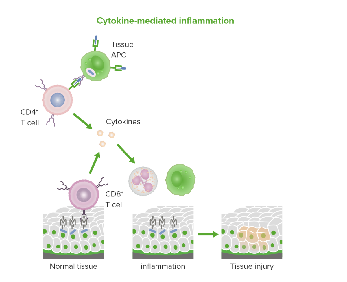 Cytokine-mediated and cytotoxic t cell-mediated inflammation in type iv hypersensitivity