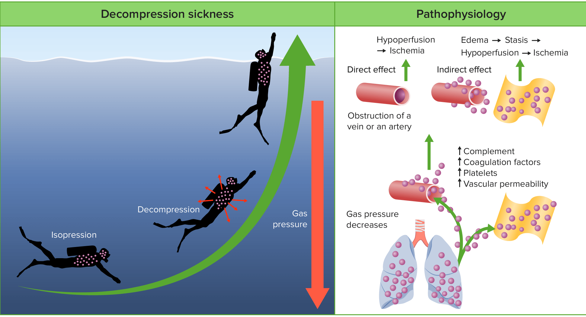 Decompression Sickness | Concise Medical Knowledge