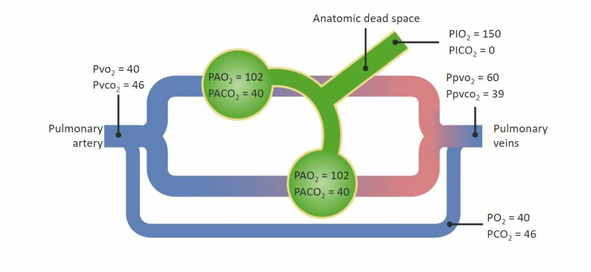 Diagrama hipoxemia respiratória troca gasosa