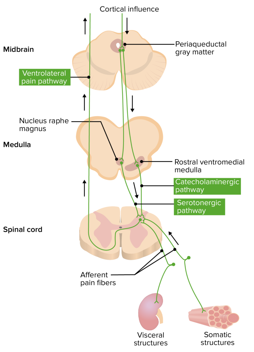 Diagrama que ilustra la teoría de convergencia-proyección del dolor visceral