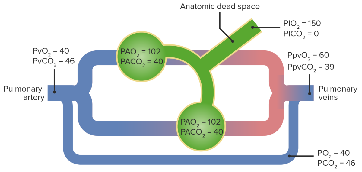 respiration dead space vs shunt