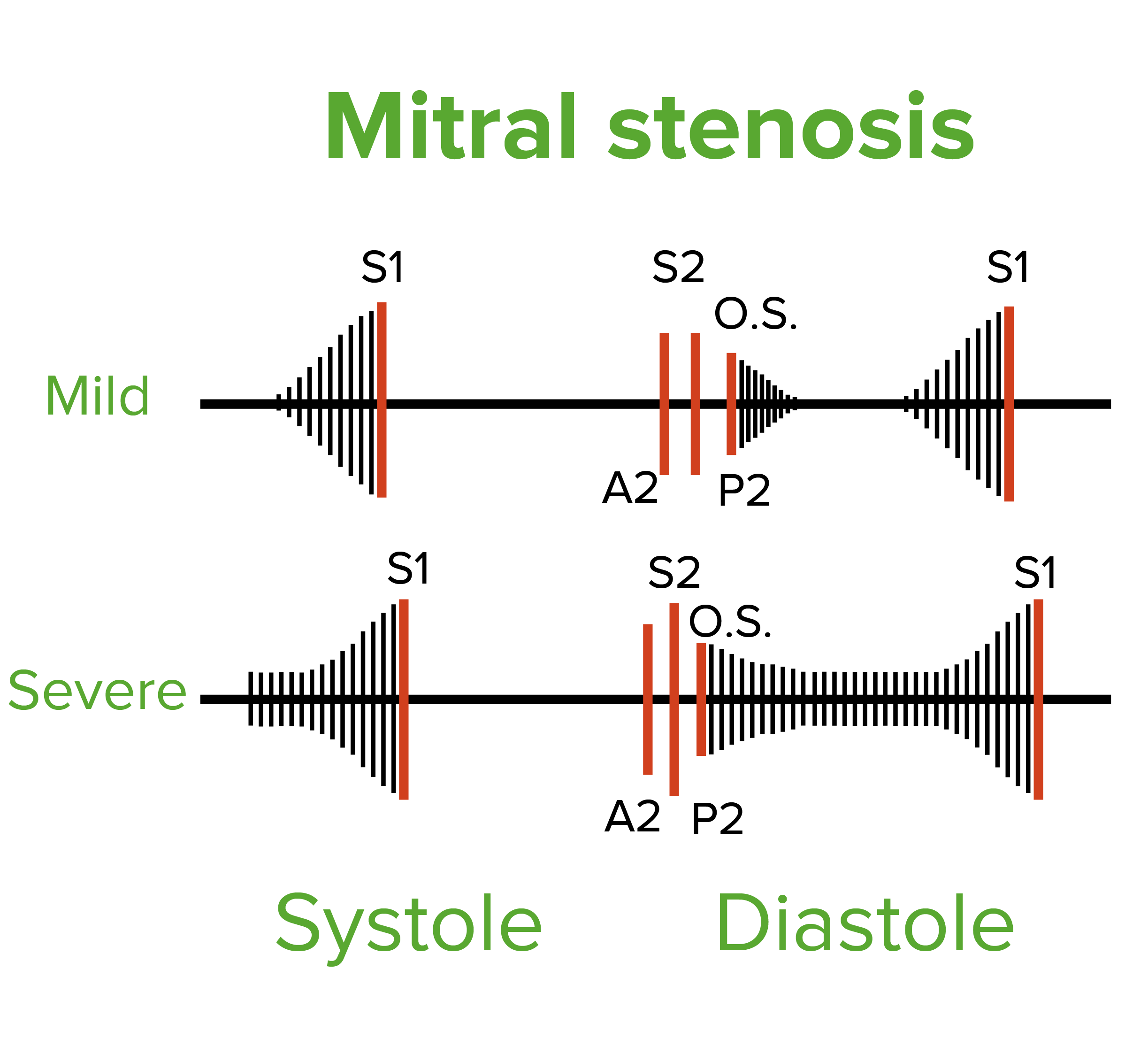 Heart Sounds Concise Medical Knowledge