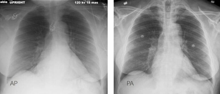 Imaging of the Heart and Great Vessels | Concise Medical Knowledge