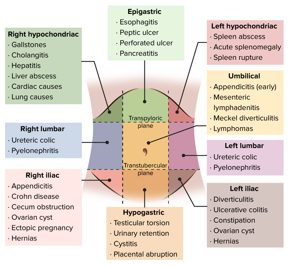 Differential diagnosis of acute abdomen