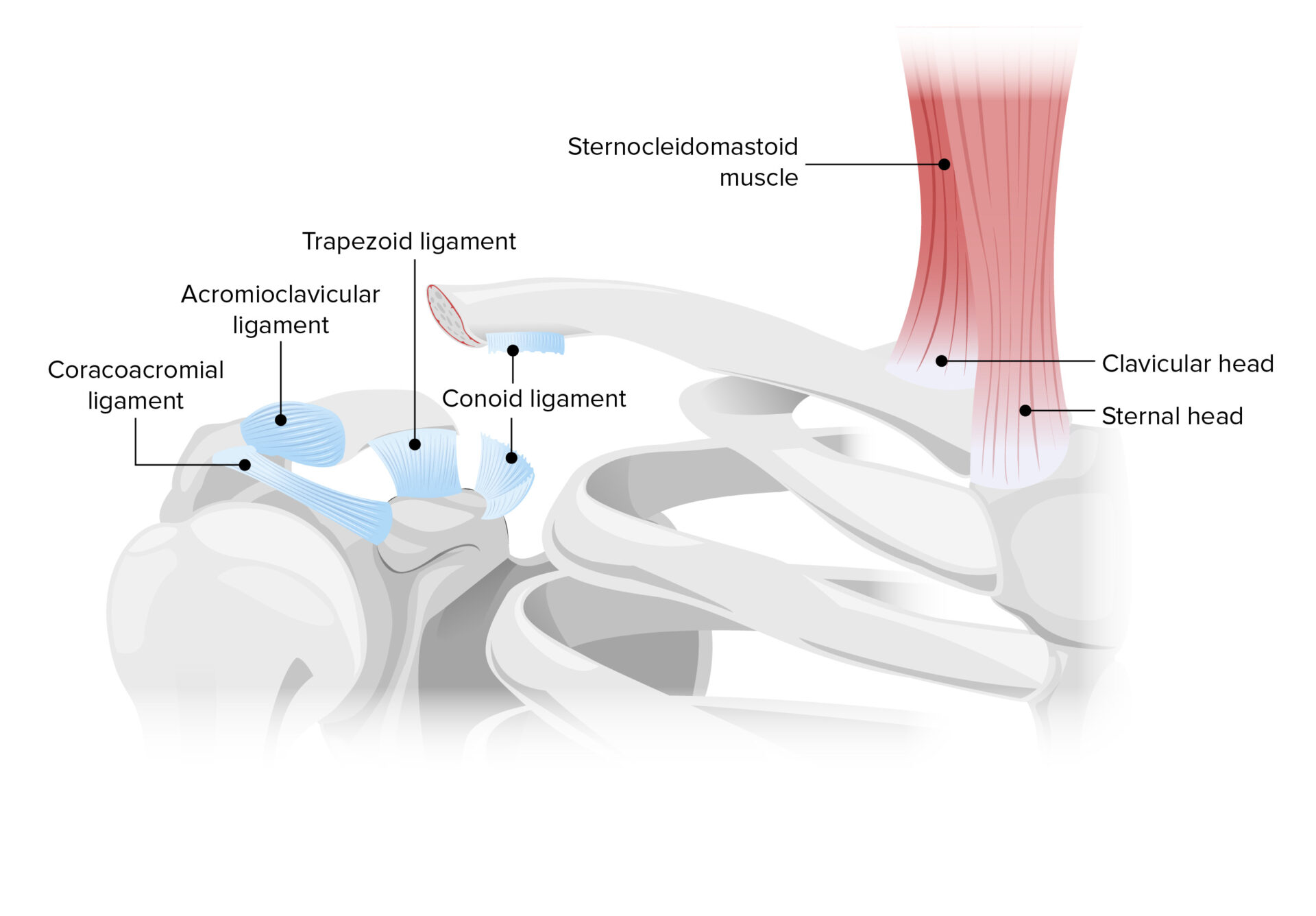 Clavicle Fracture Concise Medical Knowledge