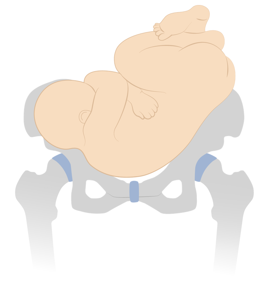 face presentation mentum posterior