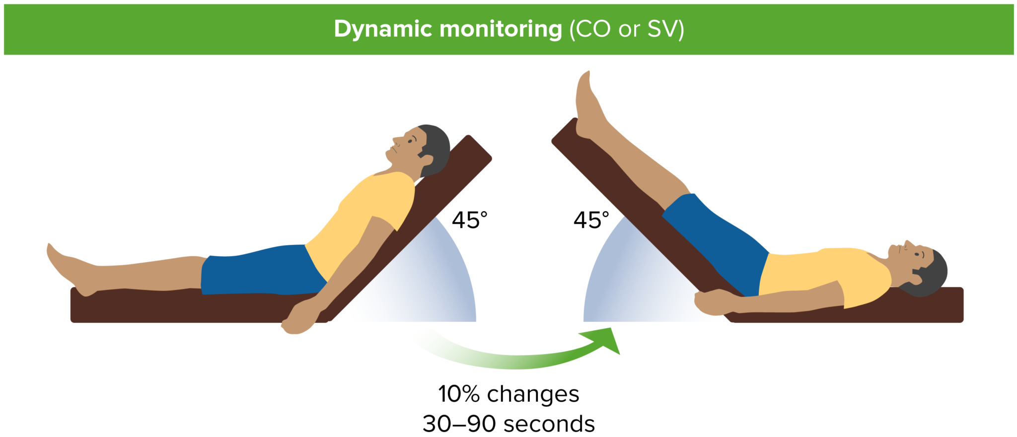 Types of Shock Concise Medical Knowledge