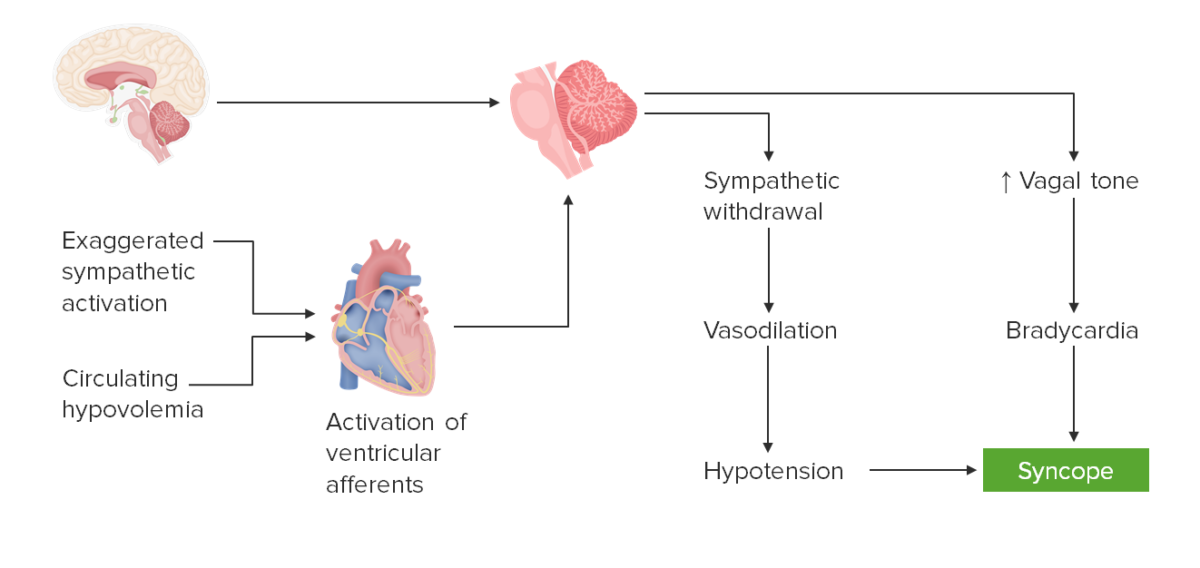 Dynamics of neurocardiogenic syncope