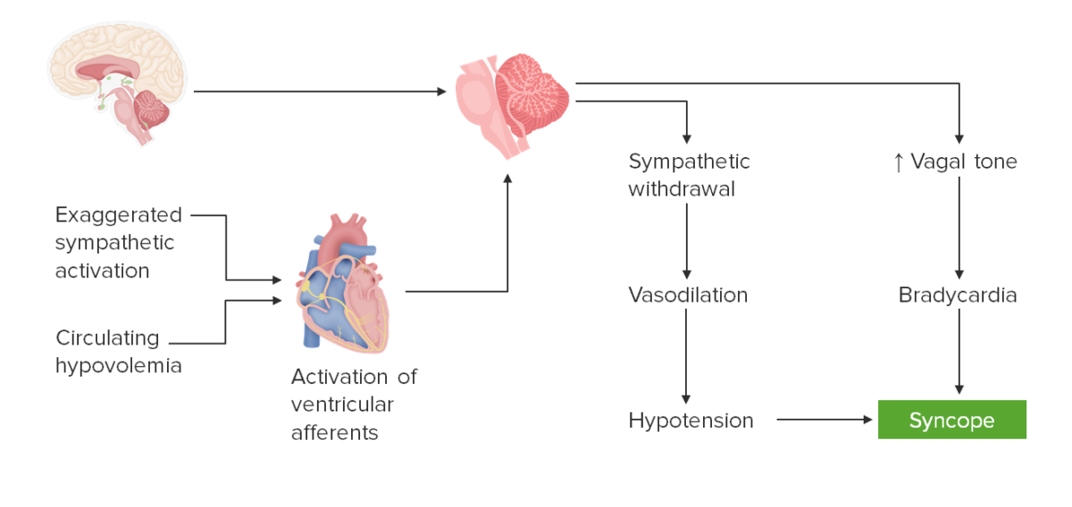 Dinâmica da síncope neurocardiogénica