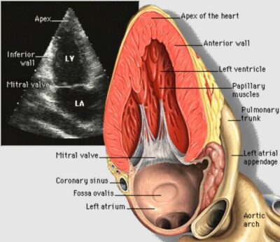Imaging of the Heart and Great Vessels | Concise Medical Knowledge