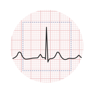 Electrocardiogram ecg interpretation