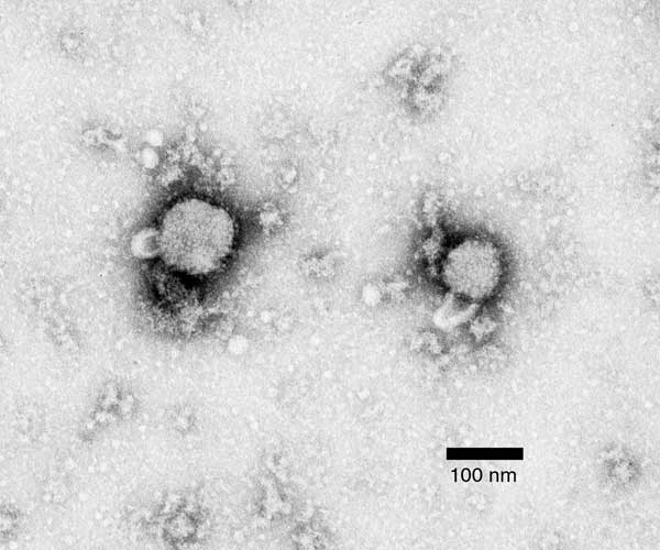 Micrografia eletrônica do vírus da coriomeningite linfocítica