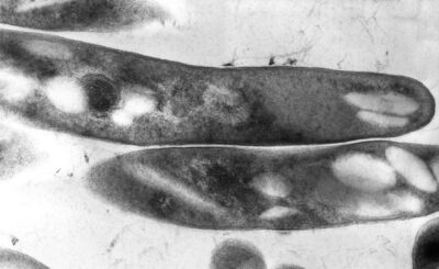 Electron micrograph of m. Tuberculosis