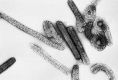 Electron micrograph of marburg virus virions