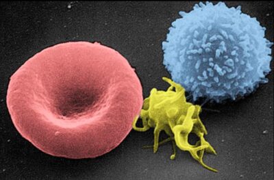 Electron micrograph of blood cells