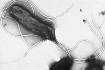 Electron micrograph of helicobacter pylori