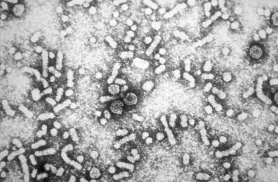 Electron micrograph of the hepatitis b virus