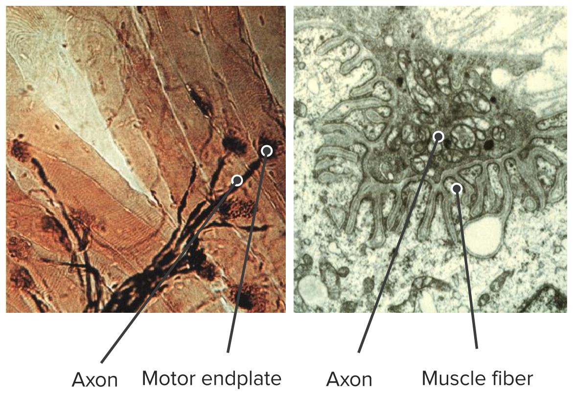 Electron micrograph showing the neuromuscular junction