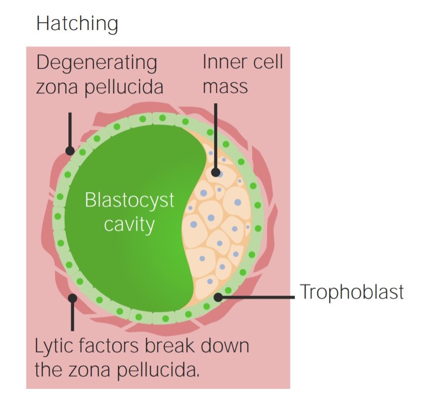 Embryoblast and trophoblast surrounded by the degenerating zona pellucida
