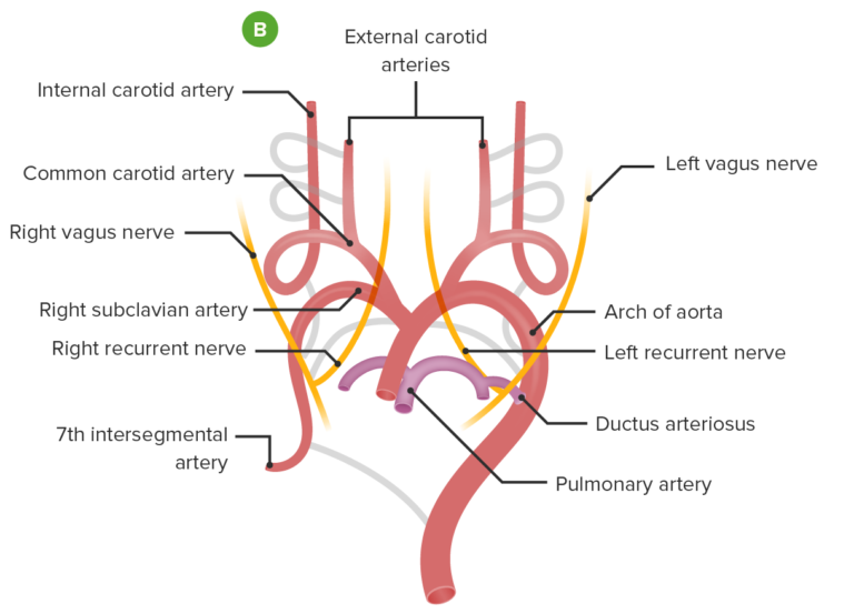 Vascular Rings Concise Medical Knowledge