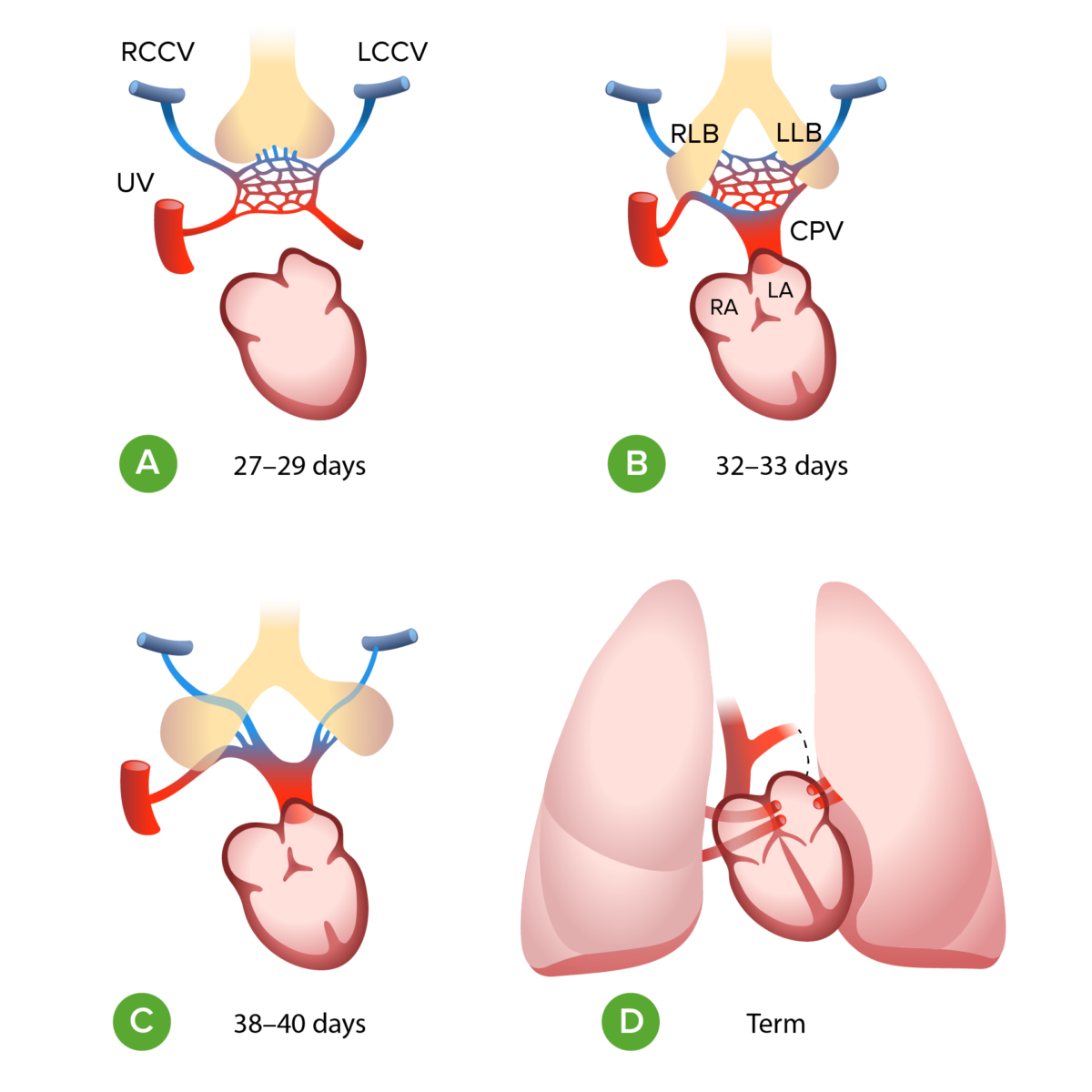 Embriología de retorno venoso pulmonar total anómalo