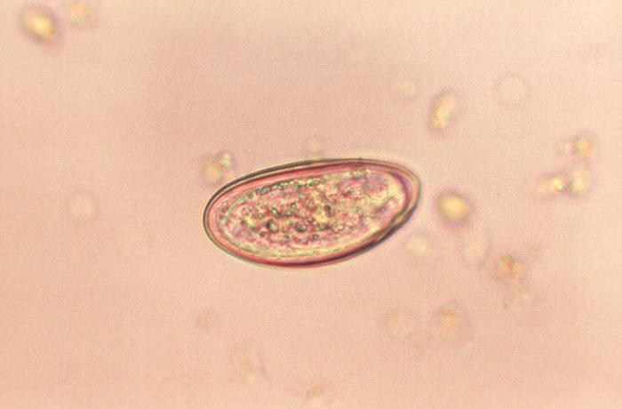 enterobius usmle condyloma acuminatum hpv type 6 11