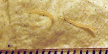 enterobiasis medscape)