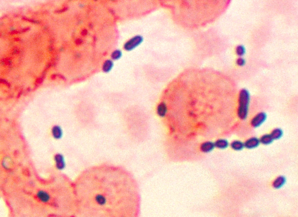 Enterococcus isolated from a lung tissue in a patient with pneumonia