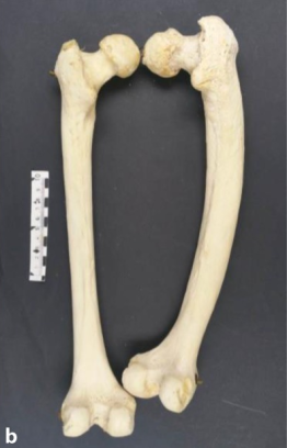 Pagetic human femur