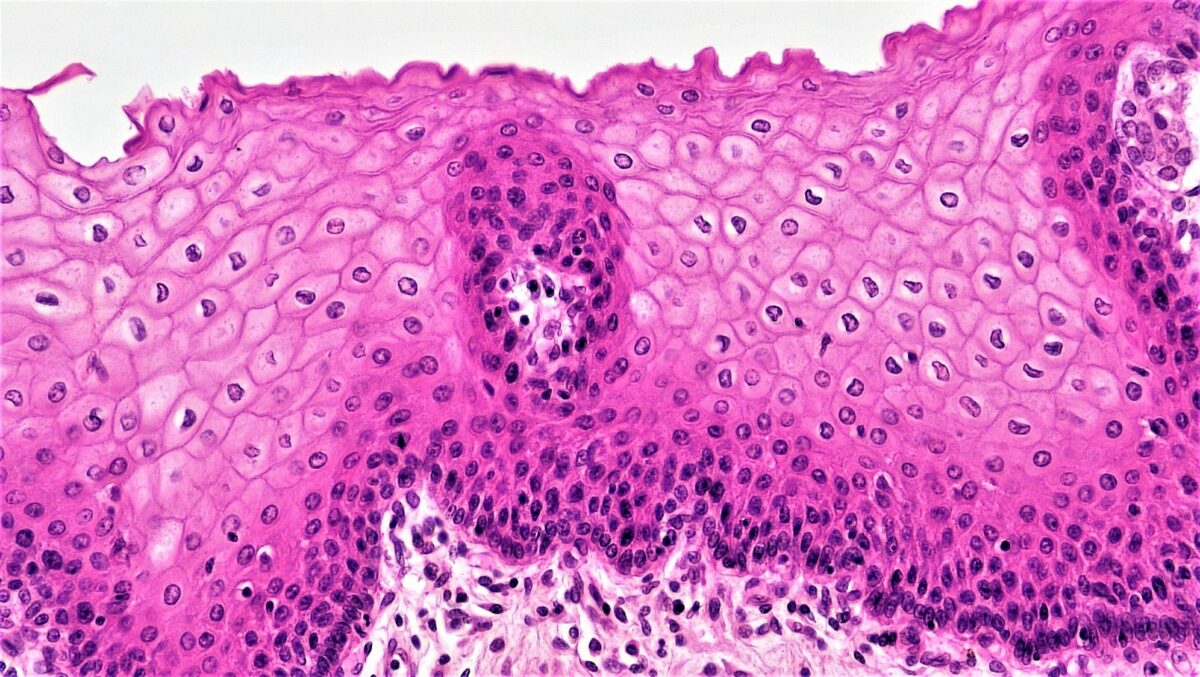 Epithelial tissues stratified squamous epithelium